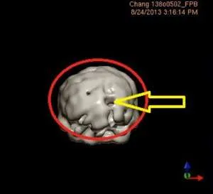 Brain scan cross section
