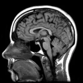Brain anatomy reference image